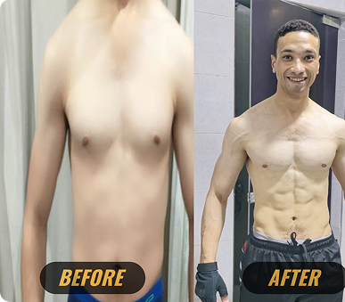 Before transformation photo