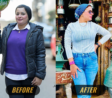 Before transformation photo
