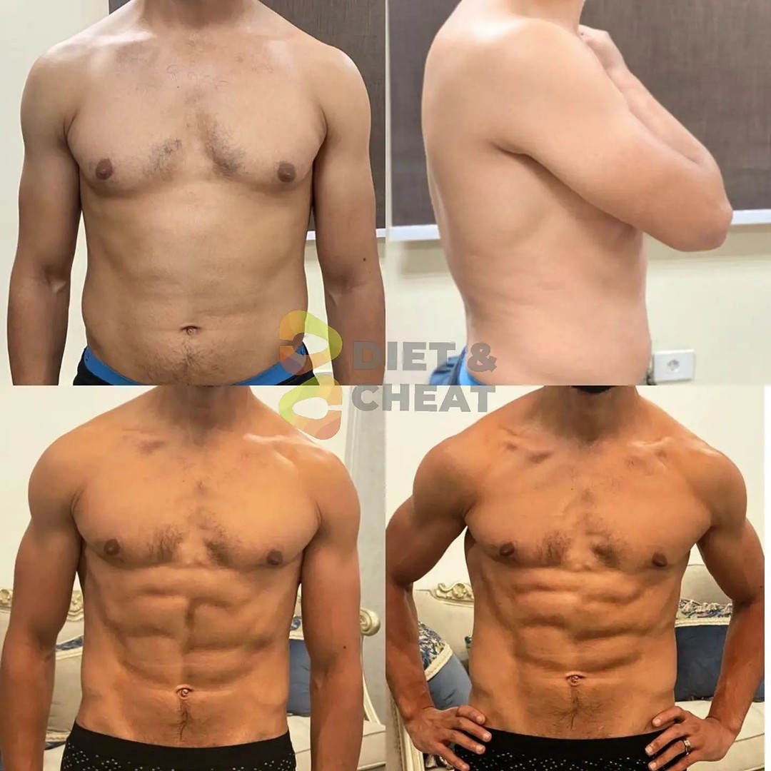 Before transformation photo
